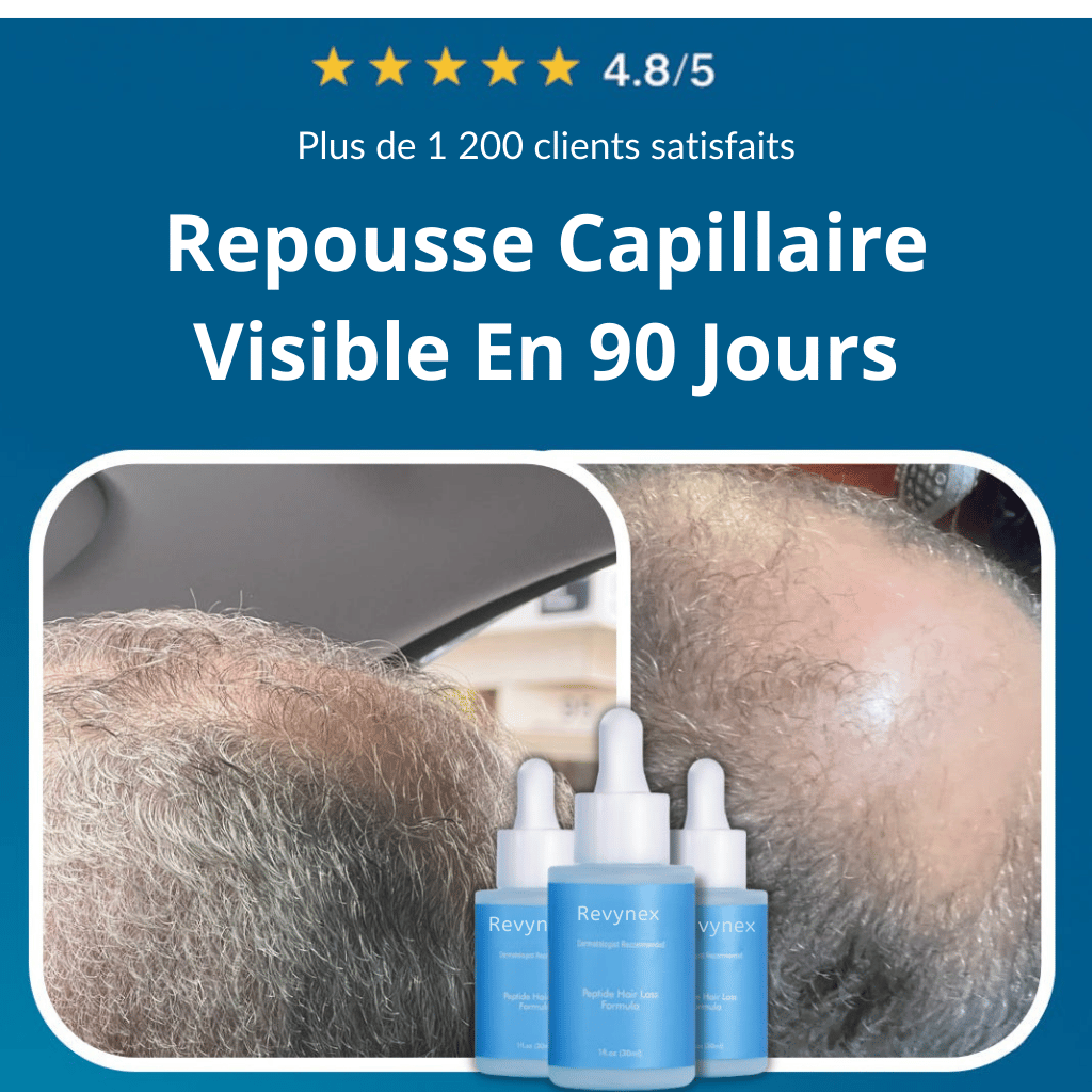 Revynex | Système Régénération Capillaire