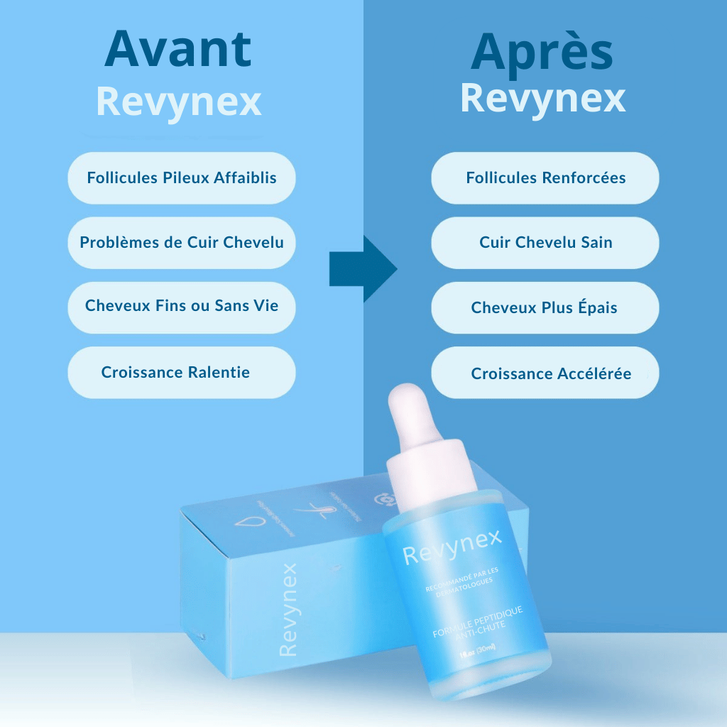 Revynex | Système Régénération Capillaire